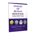 [Book] Images of Human Behavior - A Brain SPECT Atlas