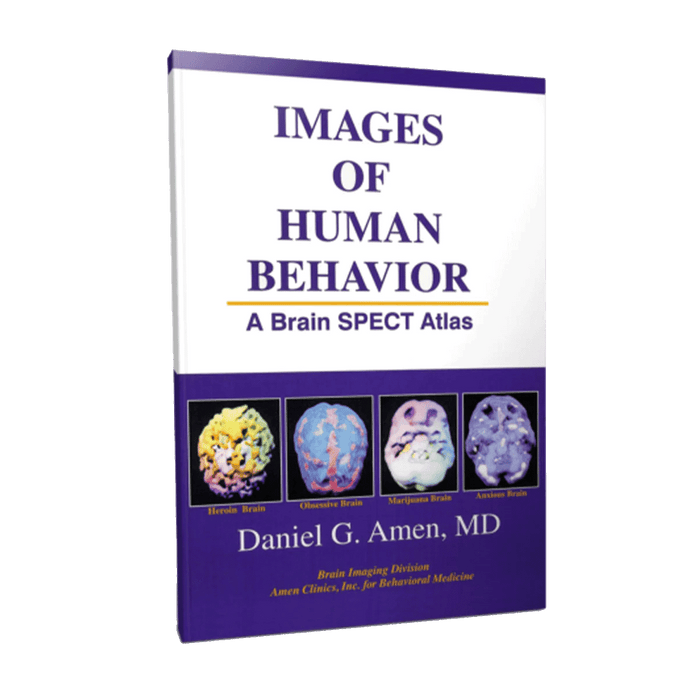 [Book] Images of Human Behavior - A Brain SPECT Atlas
