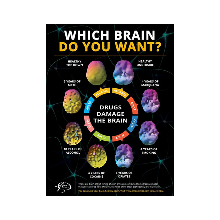 [Poster large] Which Brain Do You Want?